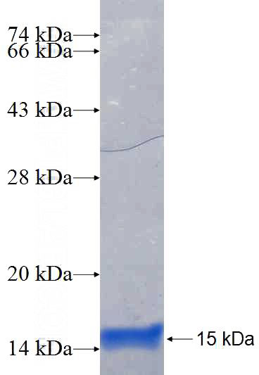 Recombinant Human GRAMD4 SDS-PAGE