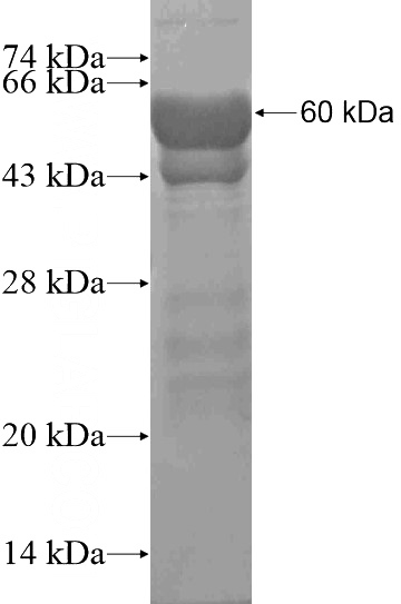 Recombinant Human MYBPC2 SDS-PAGE