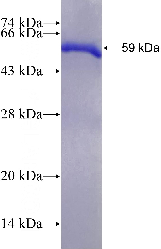 Recombinant Human ATRIP SDS-PAGE