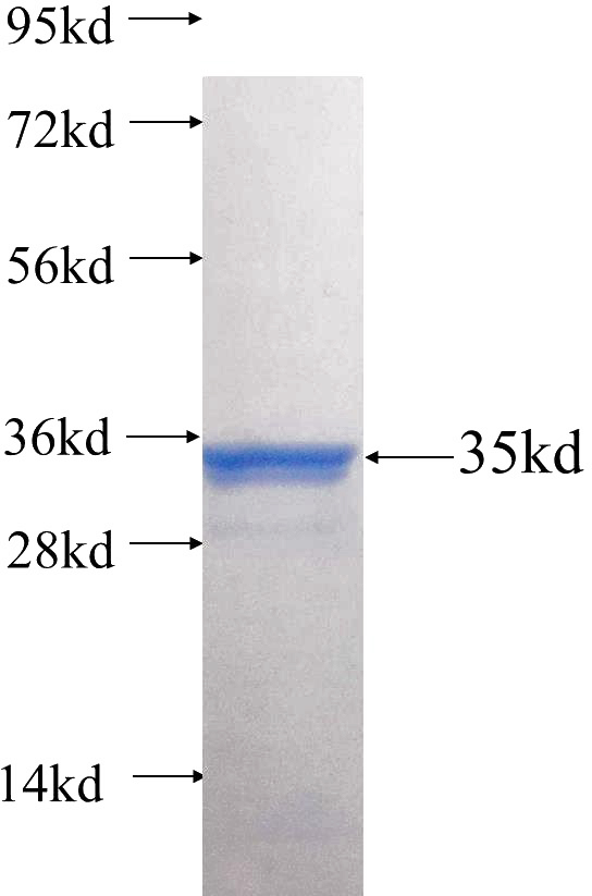 Recombinant Human SLC4A10 SDS-PAGE