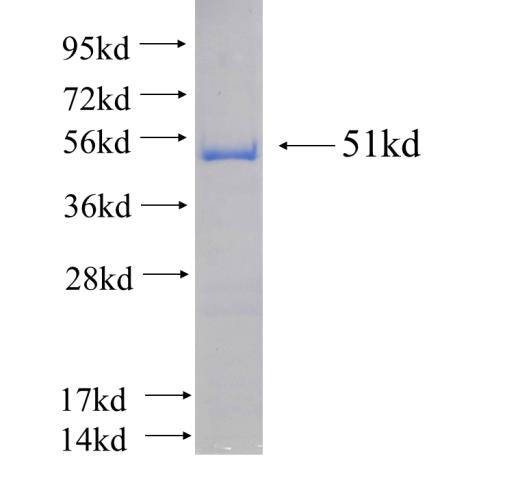 Recombinant human N6AMT2 SDS-PAGE