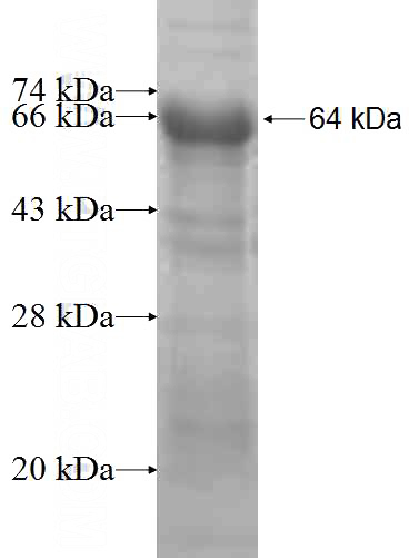 Recombinant Human STOX1 SDS-PAGE