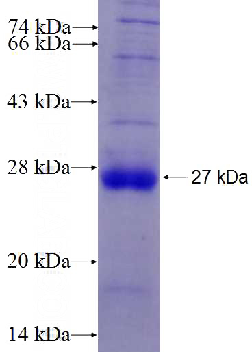 Recombinant Human HSPBP1 SDS-PAGE