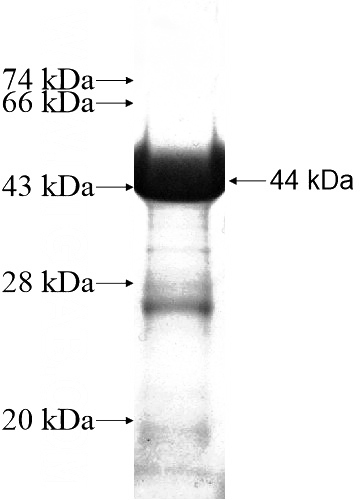 Recombinant Human ZFHX3 SDS-PAGE
