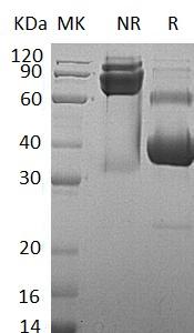 Human ACVR2A/ACVR2 (Fc & His tag) recombinant protein