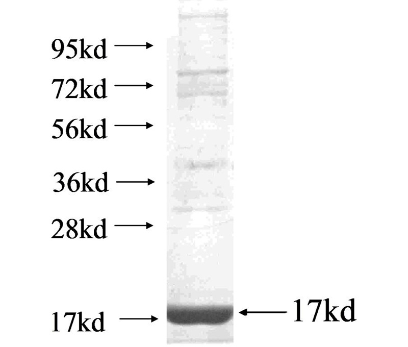 Recombinant human DUSP21 SDS-PAGE