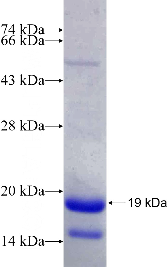 Recombinant Human SLC5A5 SDS-PAGE