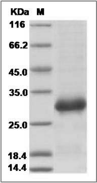 Human TNFRSF11A Protein (His Tag) SDS-PAGE