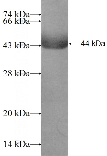Recombinant Human PIAS2 SDS-PAGE