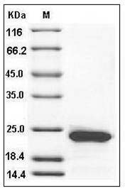Rat RBP4 Protein (His Tag) SDS-PAGE