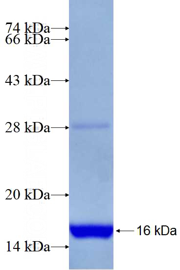 Recombinant Human CCDC123 SDS-PAGE