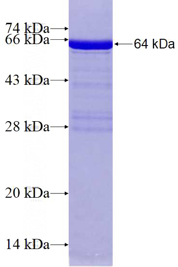 Recombinant Human HIF1AN SDS-PAGE