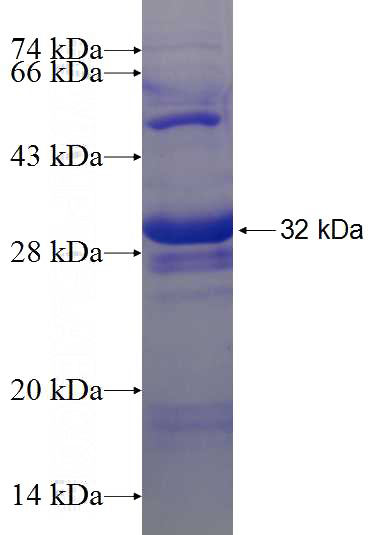 Recombinant Human IL-28RA SDS-PAGE