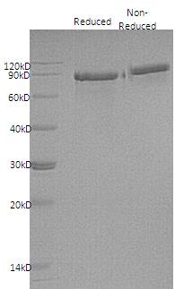 Human TF/PRO1400 (His tag) recombinant protein