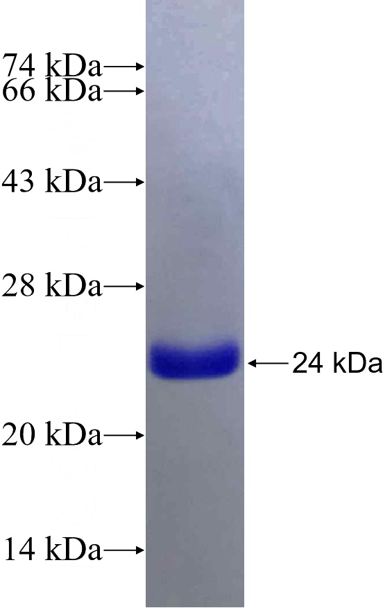 Recombinant Human PTGIS SDS-PAGE