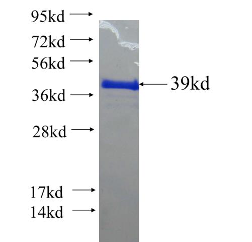 Recombinant human ZNF48 SDS-PAGE
