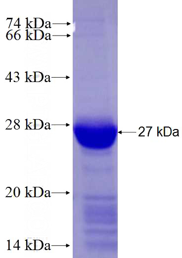 Recombinant Human DOK5 SDS-PAGE