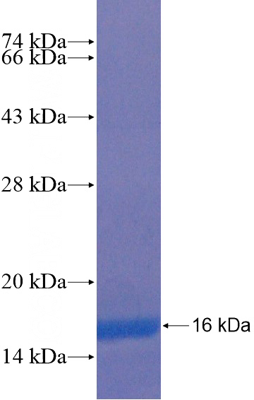 Recombinant Human UTS2R SDS-PAGE