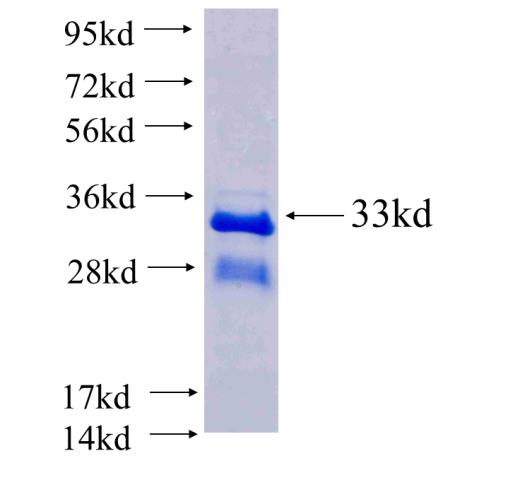 Recombinant human CYYR1 SDS-PAGE