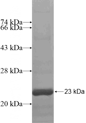 Recombinant Human ZNF74 SDS-PAGE