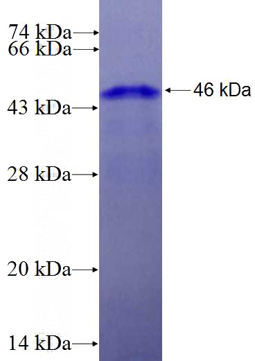 Recombinant Human DDX18 SDS-PAGE