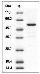 Human CNDP2 / CPGL / PEPA Protein (His Tag) SDS-PAGE