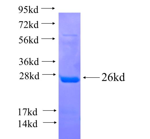 Recombinant human CLCNKA SDS-PAGE
