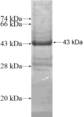 Recombinant Human CSAD SDS-PAGE