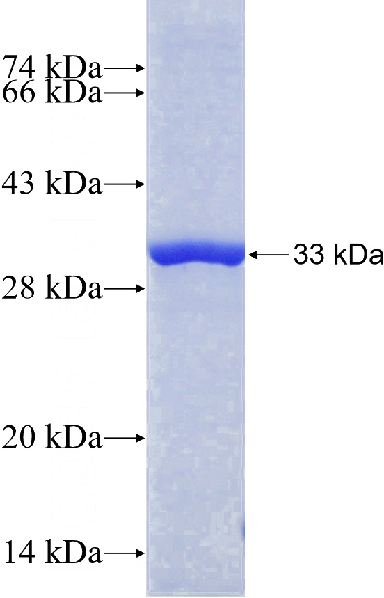 Recombinant Human PPP2R5A SDS-PAGE