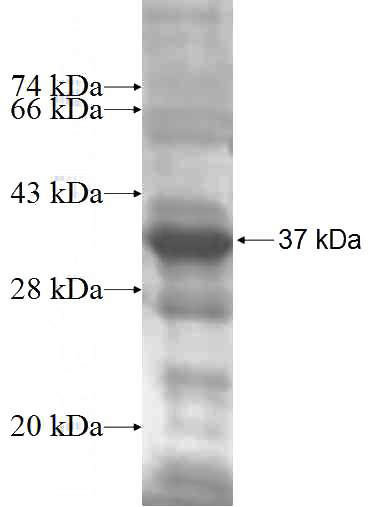 Recombinant Human HAGHL SDS-PAGE