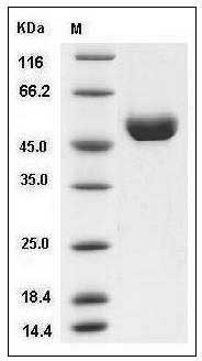 Human Cathepsin D / CTSD Protein (His Tag) SDS-PAGE