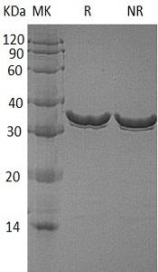Human ANXA1/ANX1/LPC1 recombinant protein