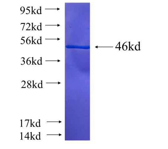 Recombinant human DCTD(Full length) SDS-PAGE