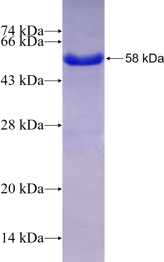 Recombinant Human UMPS SDS-PAGE