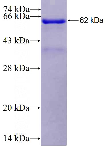 Recombinant Human BCAT1 SDS-PAGE