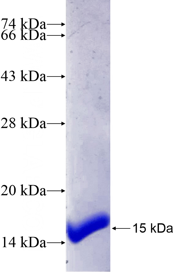 Recombinant Human CENPE SDS-PAGE