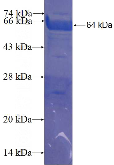 Recombinant Human ZNF202 SDS-PAGE