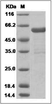 Mouse IL17B / IL-17B Protein (Fc Tag) SDS-PAGE