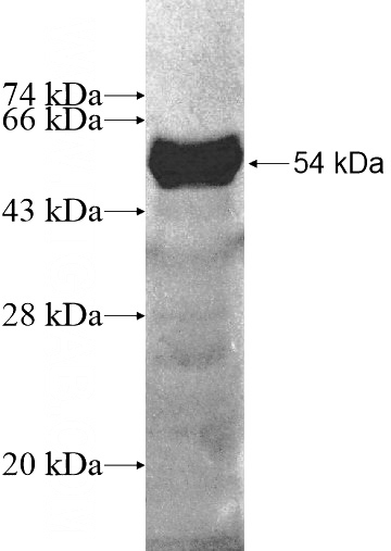 Recombinant Human USHBP1 SDS-PAGE