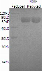 Human IL6R (His tag) recombinant protein