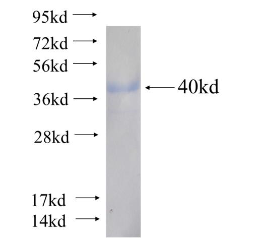 Recombinant human SHARPIN(Full length) SDS-PAGE