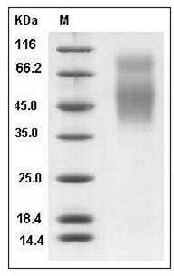 Rat CD86 / B7-2 Protein (His Tag) SDS-PAGE