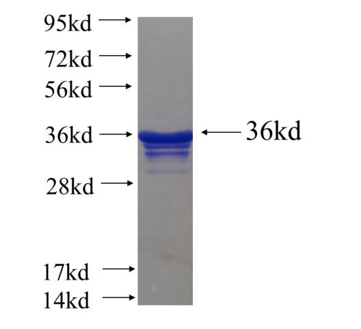 Recombinant human KRT40 SDS-PAGE