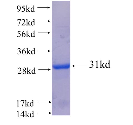 Recombinant human FBXO32 SDS-PAGE