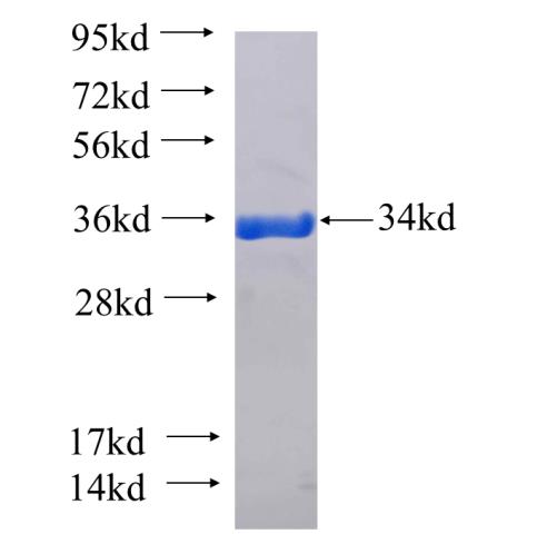 Recombinant human SLC13A3 SDS-PAGE