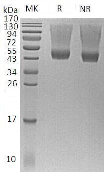 Human DCN/SLRR1B (His tag) recombinant protein