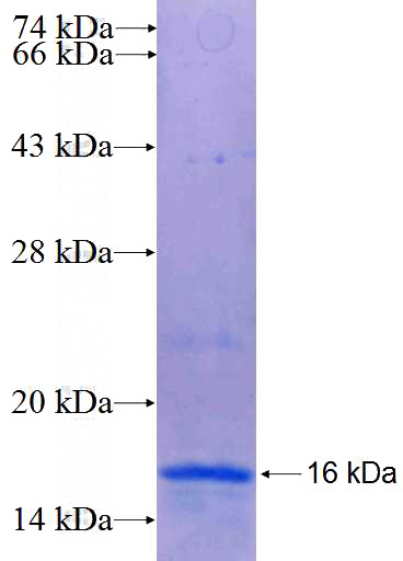 Recombinant Human NOP14 SDS-PAGE
