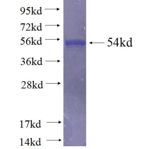 Recombinant human SNRPA1 SDS-PAGE
