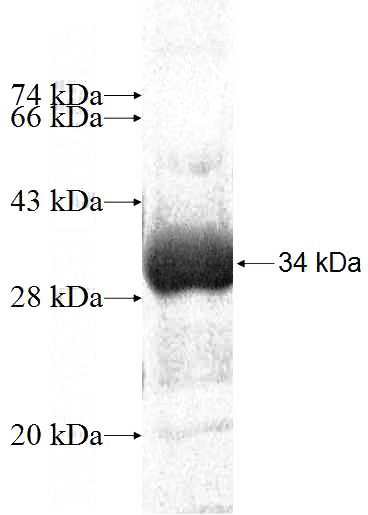 Recombinant Human DGUOK SDS-PAGE