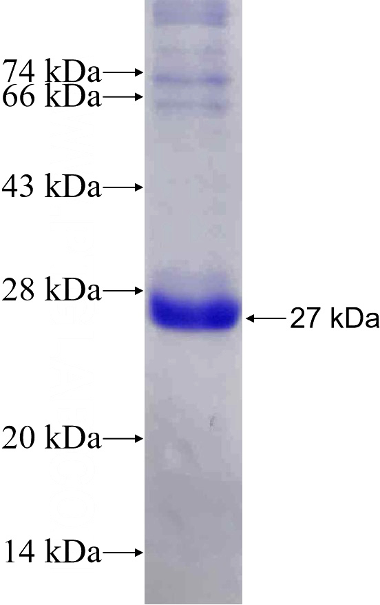 Recombinant Human SOCS1 SDS-PAGE